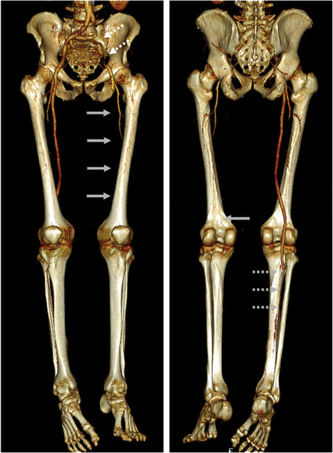 Trial clinici