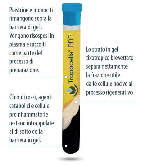 Provetta Tropocell commentata